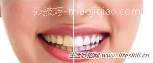 牙齿黄教你八招美白小窍门 