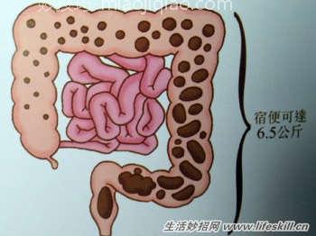 晨起两个步骤把宿便排光 