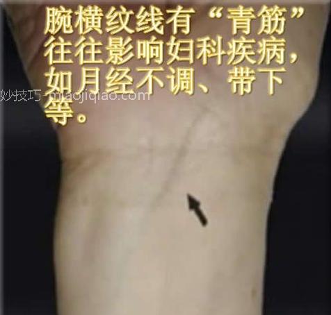 人体体表“青筋”凸起意味着什么?