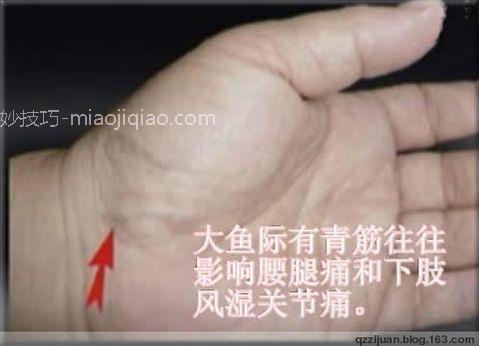 人体体表“青筋”凸起意味着什么?