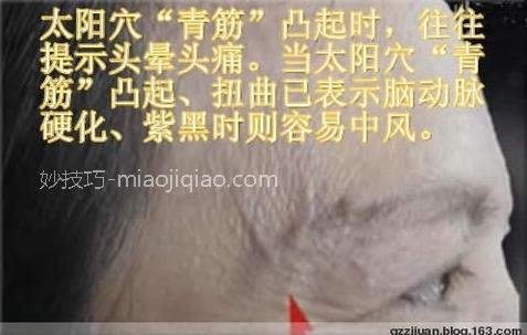人体体表“青筋”凸起意味着什么?